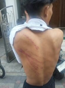 Madas Sedarah Advokasi Tiga Anak Dianiaya Bulak Rukem Surabaya